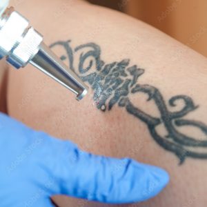 Laser Therapy Courses