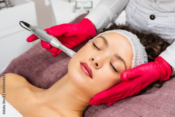Microneedling