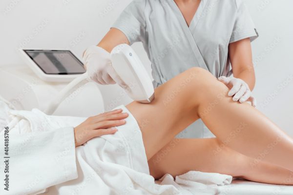Laser Hair Removal