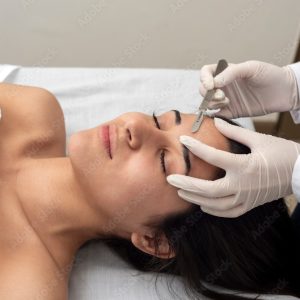 Dermaplaning